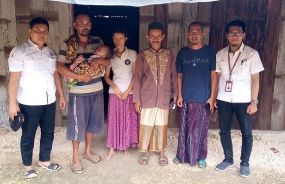 Per Tahun 90 an Kasus Gizi Buruk, Dinas Kesehatan Akui Ada Yang Sulit