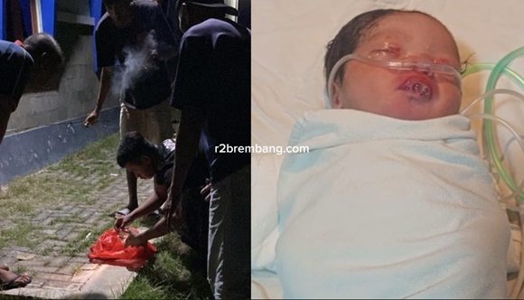 Luka Gores Punggung Bayi, Pihak RSUD Beberkan Dugaan Penyebab (Temuan Bayi Di Desa Pandean Rembang)