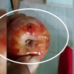 Salah satu orang tua murid di Kecamatan Sumber, menunjukkan buah apel MBG yang busuk, hari Jum’at (17/04).